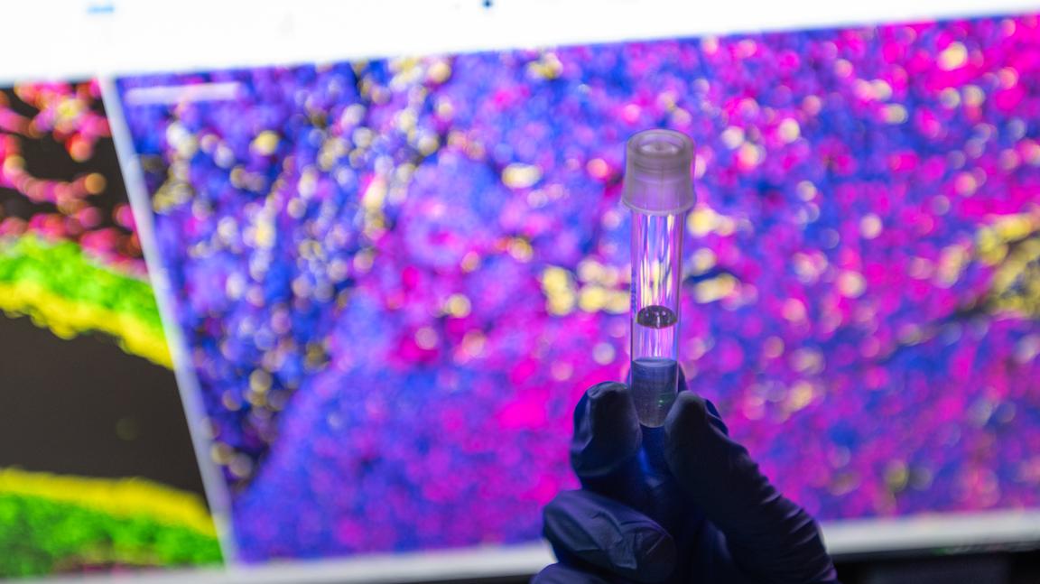 researcher holds vial in front of computer screen showing microscopic image
